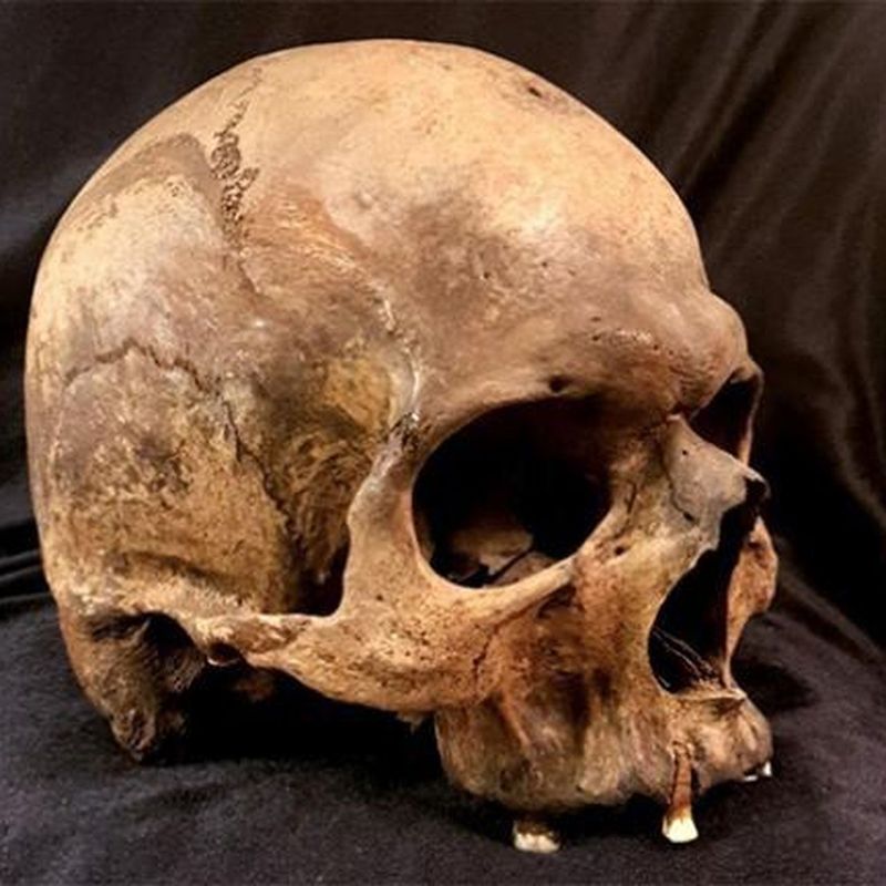 Mapping Disease Through the Ages: Ancient Pathogens in Human DNA