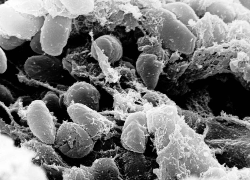 When Diseases First Jumped Species: Zoonosis and Farming