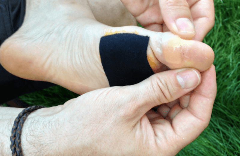 Leukotape P (1.5 in) — ~$10–$12