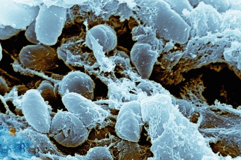 Plague's Ancient Roots and Other Pathogens