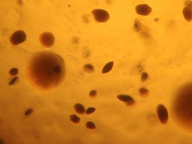 All Bacteria Are Dangerous