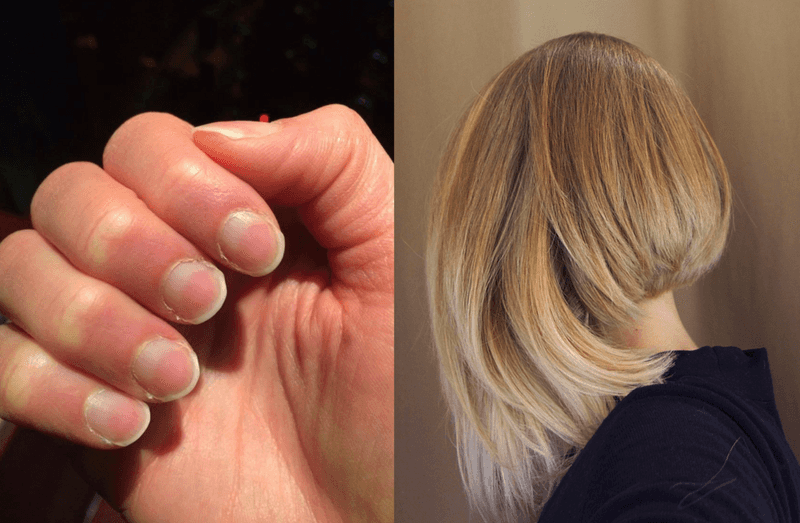 Hair and Nails Don't Keep Growing After Death