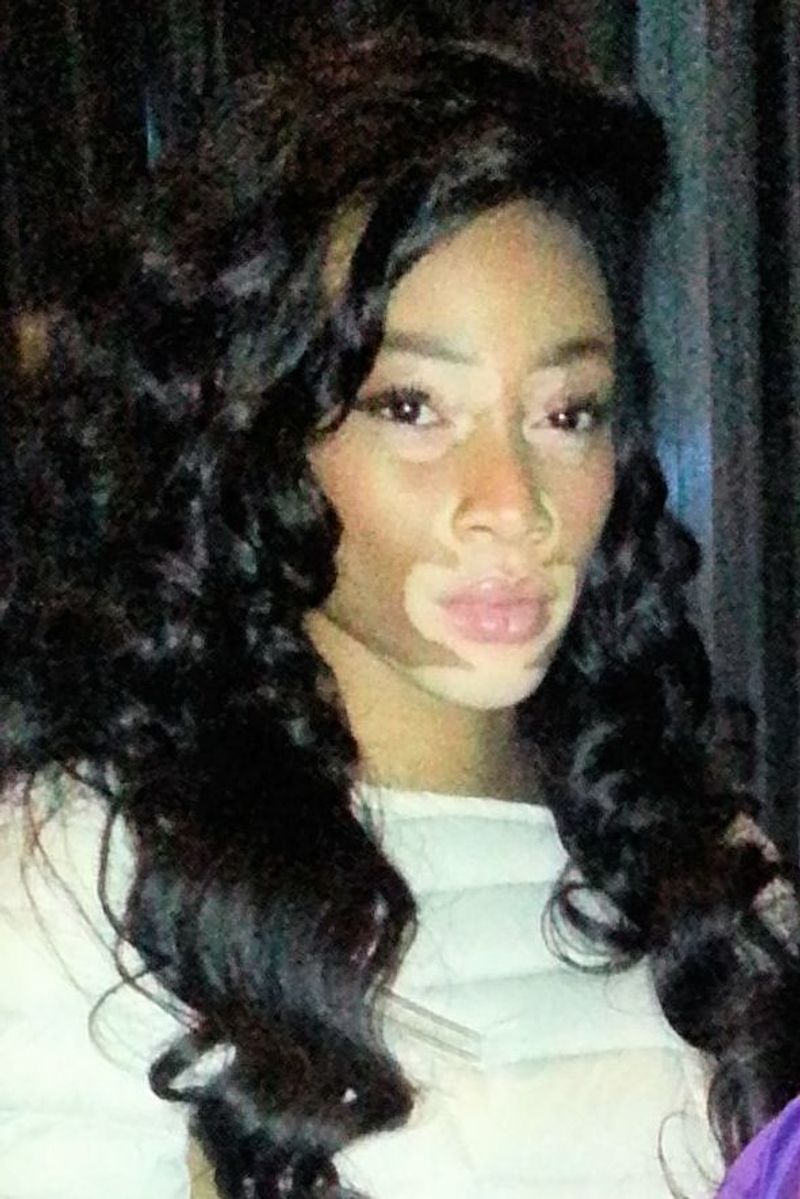 Winnie Harlow 