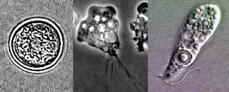 Brain-Eating Amoeba (Naegleria fowleri)