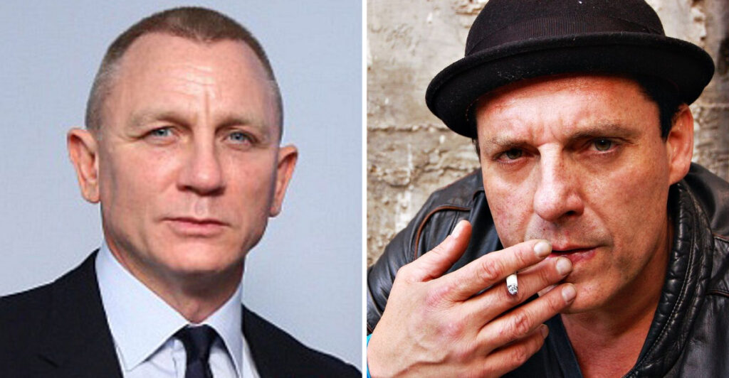 14 Actors Who Accidentally Injured Their Co-Stars on Set