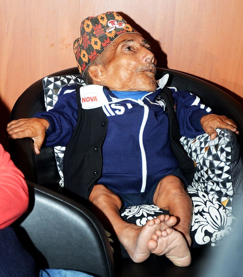 Chandra Bahadur Dangi (1939-2015) - World Record Holder Chandra Bahadur Dangi (1939-2015) - World Record Holder
