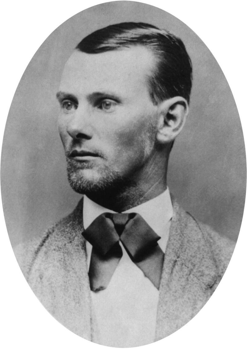 Jesse James' Near-Fatal Childhood Injury Jesse James' Near-Fatal Childhood Injury