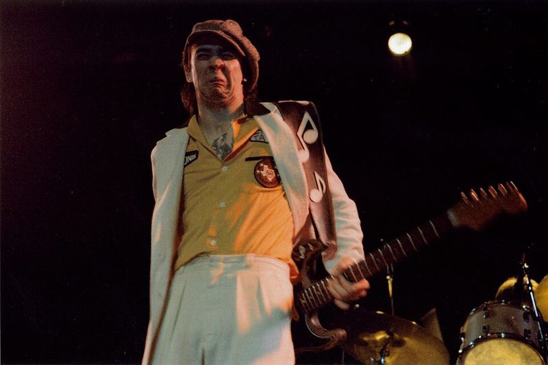 Stevie Ray Vaughan's Hands Paid the Price for His Sound Stevie Ray Vaughan's Hands Paid the Price for His Sound