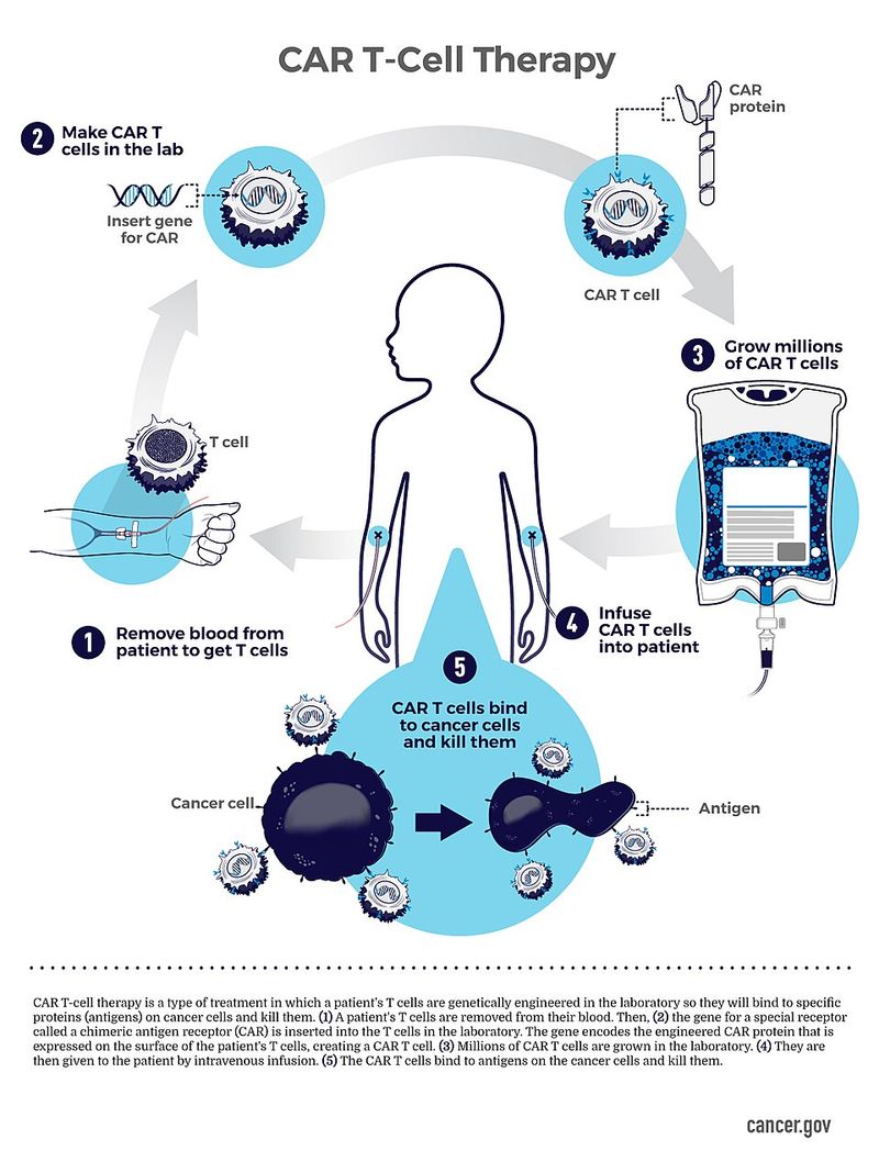 CAR-T Cell Therapy CAR-T Cell Therapy