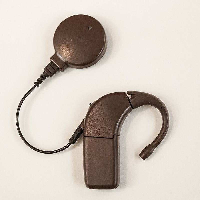 Cochlear Implants Cochlear Implants