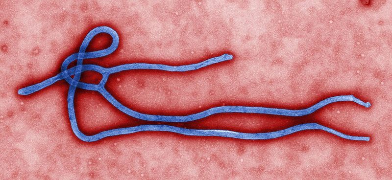 Ebola Virus Disease Ebola Virus Disease