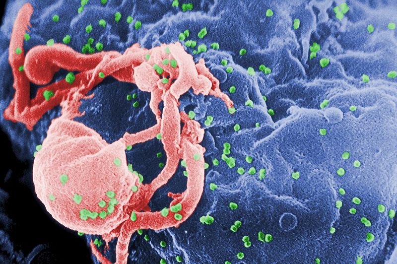 HIV/AIDS HIV/AIDS