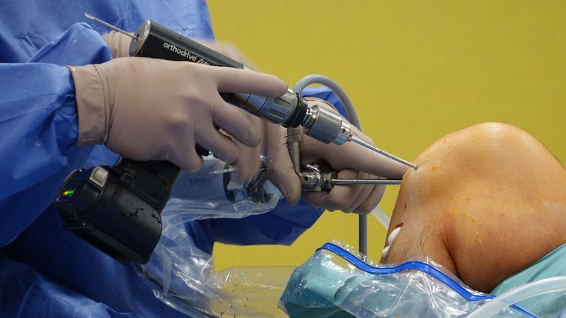 Minimally Invasive Surgery Minimally Invasive Surgery
